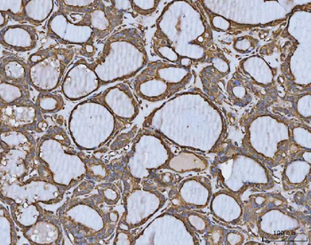 MTHFD1 Antibody
