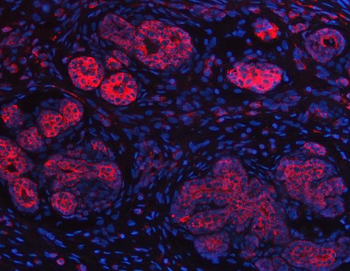 IMPDH2 Antibody