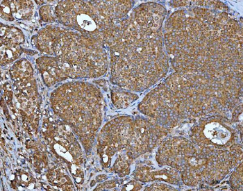 IMPDH2 Antibody