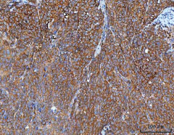 IMPDH2 Antibody