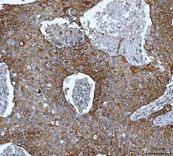 IMPDH2 Antibody
