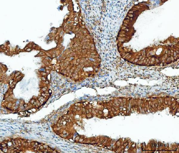IMPDH2 Antibody