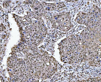 HDAC1 Rabbit Polyclonal Antibody