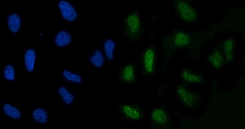 GLIS1 Antibody