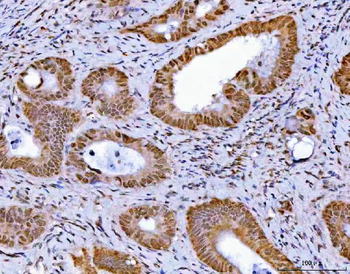 GLIS1 Antibody
