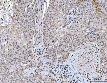 GLIS1 Antibody