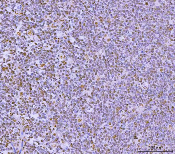 GLIS1 Antibody