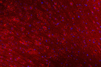 CLASP1 Antibody