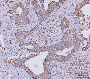 CLASP1 Antibody