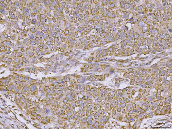 CLASP1 Antibody