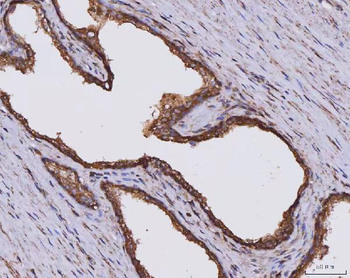 CLASP1 Antibody