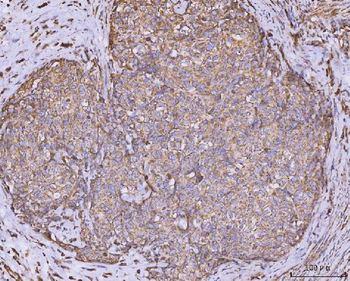 CLASP1 Antibody