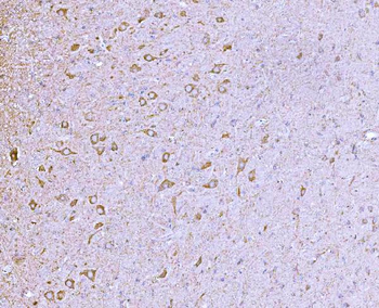 CLASP1 Antibody