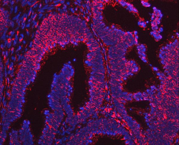 ARL1 Rabbit Polyclonal Antibody