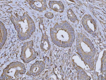 ARL1 Rabbit Polyclonal Antibody