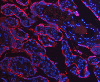 Annexin A10/ANXA10 Rabbit Polyclonal Antibody