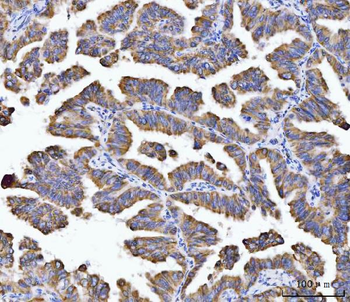 Aconitase 2 Antibody (monoclonal, 4C12D1)
