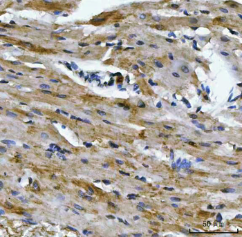 Aconitase 2 Antibody (monoclonal, 4C12D1)