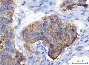 gamma Catenin Mouse Monoclonal Antibody