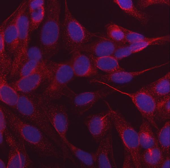 NDP52/CALCOCO2 Mouse Monoclonal Antibody
