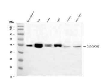 NDP52/CALCOCO2 Mouse Monoclonal Antibody