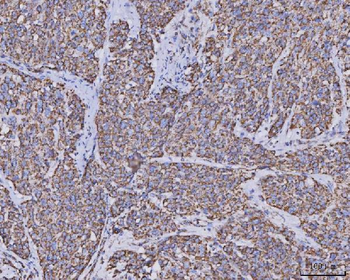 MDH2 Antibody (monoclonal, 5D8C1)