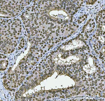 PC4/SUB1 Antibody (monoclonal, 8D9D1)