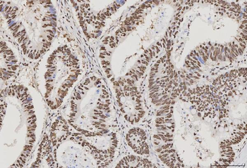 PC4/SUB1 Antibody (monoclonal, 8D9D1)