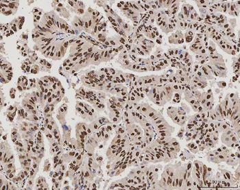 PC4/SUB1 Antibody (monoclonal, 8D9D1)
