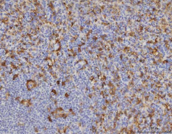ME1 Antibody (monoclonal, 5E5F7)
