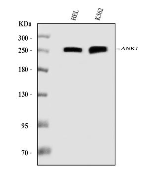 Ankyrin erythroid/ANK/ANK1 Mouse Monoclonal Antibody