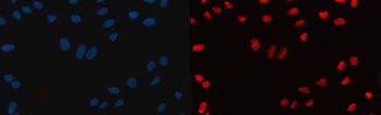 CPSF6 Antibody (monoclonal, 3F11E1)