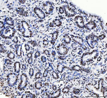 CPSF6 Antibody (monoclonal, 3F11E1)