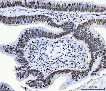 CPSF6 Antibody (monoclonal, 3F11E1)