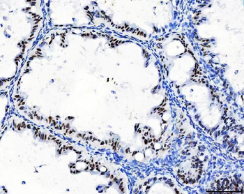 CPSF6 Antibody (monoclonal, 3F11E1)
