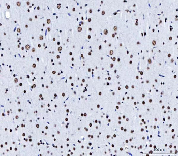 CPSF6 Antibody (monoclonal, 3F11E1)