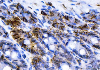 NKCC1/SLC12A2 Mouse Monoclonal Antibody