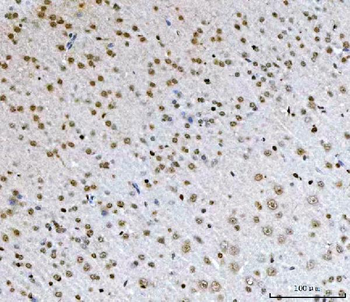 AREB6/ZEB1 Antibody (monoclonal, 8B12D7)