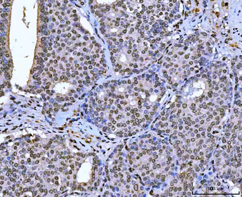 AREB6/ZEB1 Antibody (monoclonal, 8B12D7)