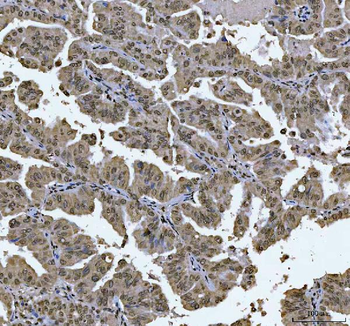 AREB6/ZEB1 Antibody (monoclonal, 8B12D7)