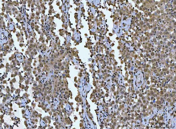 AREB6/ZEB1 Antibody (monoclonal, 8B12D7)