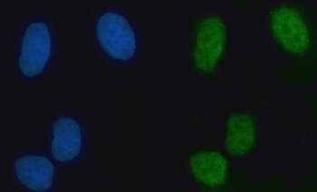 RAMP/ZMYM2 Rabbit Polyclonal Antibody
