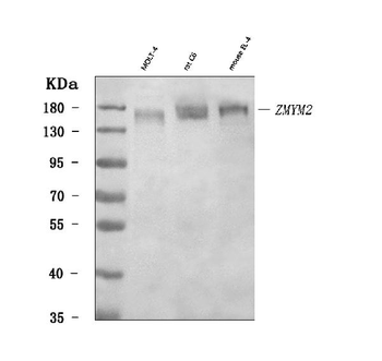 RAMP/ZMYM2 Rabbit Polyclonal Antibody