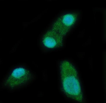 YTHDC2 Rabbit Polyclonal Antibody
