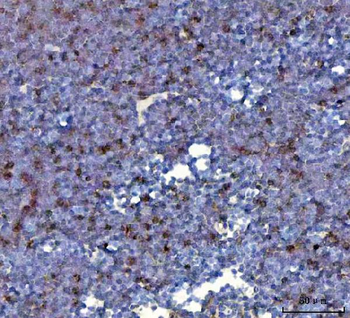 CCXCR1/XCR1 Antibody