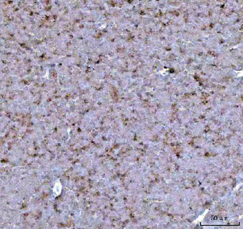 CCXCR1/XCR1 Antibody