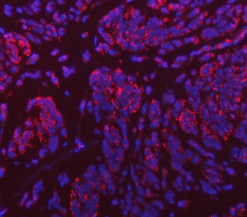 VPS53 Antibody