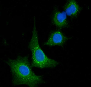 VPS53 Antibody