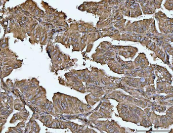 VPS53 Antibody