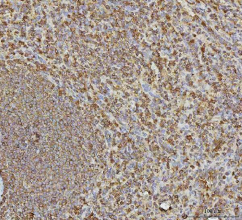 VPS53 Antibody